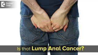 A lump down there – Is it cancer? Is it Piles ? Facts Revealed- Dr. Rajasekhar M R  Doctors Circle