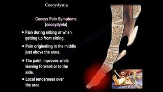 Coccydynia  coccyx pain - Everything You Need To Know - Dr. Nabil Ebraheim