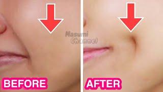How To Get Dimples Fast & Naturally Simple Facial Exercises to get Dimples without Surgery