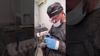  Встановлення зубного імпланта Straumann. #стоматологія #зуби #імпланти #straumann