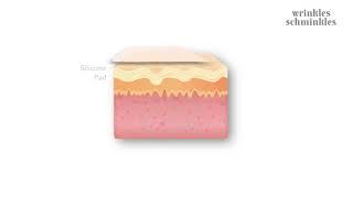 How Wrinkles Schminkles Silicone Patches for Wrinkles Work