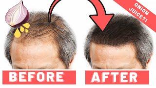 Onion Juice For Hair Growth - Does It Work 2019?