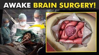 Why Patient Is Awake During This Brain Surgery? Awake Craniotomy
