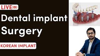 Live dental implant surgery  Are dental implant painful  डेंटल इमप्लान्ट मै कितना दर्द  होता है