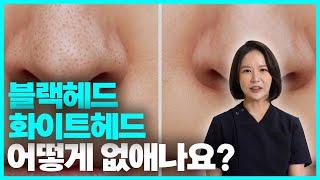 블랙헤드 화이트헤드 어떻게 없애나요? l 블랙헤드 화이트헤드 관리법