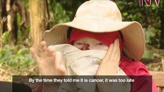 Alaisa Naibiras situation epitomises albinos challenges with skin cancer