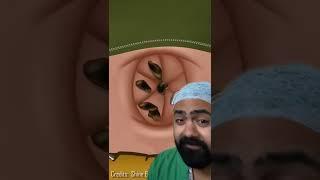 Doctor Reacts To Lost Baggage In Bellybutton