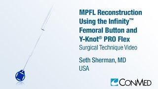 Dr. Seth Sherman - MPFL Reconstruction Using the Infinity™ Femoral Button and Y-Knot® PRO Flex