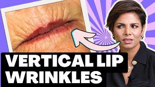LIP WRINKLES? Face massage for LIP LINES and WRINKLES   Blush with me face yoga