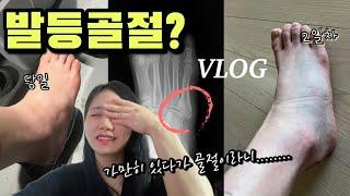 가만히 앉아있다가 날벼락... 중족골 발등골절 썰풀기 브이로그 vlog 집에서 놀아보자 I 거위의꿈 I 쉬운피아노악보추천  I 코드악보추천