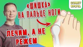 Вальгусная стопа? Лечение и гимнастика.