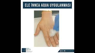 ELE İNNEA AQUA UYGULAMASI