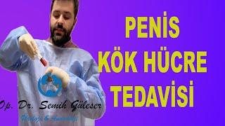 Kök Hücre Tedavisi Sertleşme Sorununda Nasıl Yapılır ? Tüm Aşamalarıyla. Gerçek Tedavi Görüntüleri