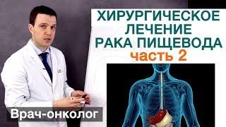 Рак пищевода - хирургическое лечение рака пищевода. Часть 2. Расположения метастаз и операция