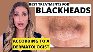 Blackheads Dermatologist Shares Best Treatments to Remove Them with Affordable Skincare Options