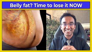 How to lose belly fat NATURALLY without complex dieting  DAWN - DUSK method to BURN fat