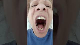 ASMR  What does your UVULA DO Dangling thing BACK YOUR THROAT girl thinks her UVULA may be swollen