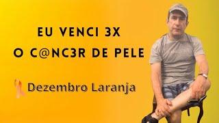 3 Vezes Mais Forte A Experiência de José Barea com o C@nc3r de Pele- Tô na Vida com Lucas Pinheiro