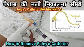 Urinary Catheter Remove कैसे करें  How to remove foleys Catheter  Foleys Catheter कैसे निकाले