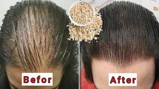 Accelerate your hair growth with this amazing mask - The secret of hair growth and strengthening