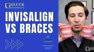 Invisalign vs Braces Tips from a Board Certified Orthodontist