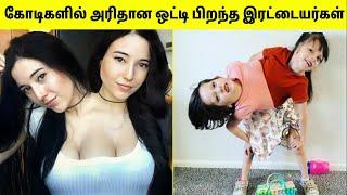 ஒட்டி பிறந்த இரட்டையர்கள்  Conjoined Twins In The World  Unbelievable Twins  TAMIL AMAZING FACTS