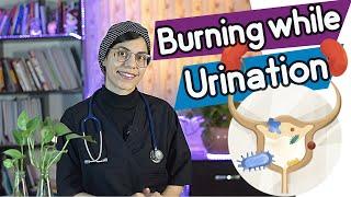 Burning while urination  treatment and causes