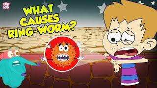 What Causes Ringworms?  Skin Infection  The Dr Binocs Show  Peekaboo Kidz
