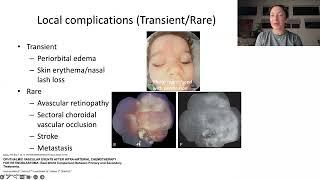 Lecture Innovations and Advances in Retinoblastoma Management