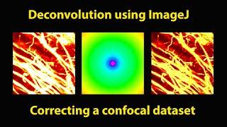 Deconvolve a confocal dataset using ImageJ