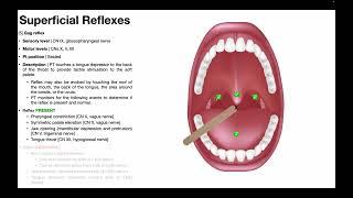 Gag Reflex  Procedure & Results Interpretation