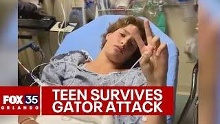 Florida teen survives alligator attack