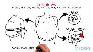 Abdominal Distension The 6 Fs that can help your diagnosis