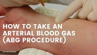 How to take blood for ABG Arterial blood gas