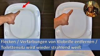 Flecken  Verfärbungen von Klobrille entfernen  Toilettensitz wird wieder strahlend weiß