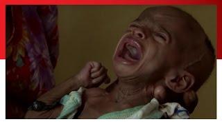 THIS is Hunger   Save the Children