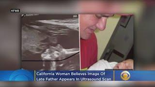 Pregnant Woman Sees Late Father Kissing Her Unborn Baby In Ultrasound Photo