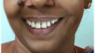 Dental treatment Nechupadam