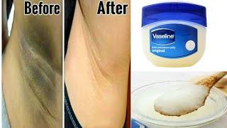 How to Get rid Of Dark Underarms in 3 Minutes  instant result  using Vaseline 100% Effective