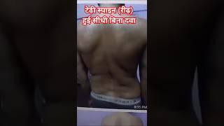 टेढ़ी Spine रीढ़ हुई सीधा बिना दवा Scoliosis Back Pain Yogguru Dheeraj Back Pain Slip Disk #shorts