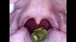 Swallowing Gummy Bears  Mouth Cam