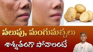 Natural Tip for Dark Spots on Face  Get Rid of Pigmentation  Dr.Manthenas Beauty Tips