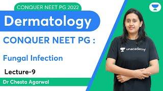 Conquer NEET PG 2022 Fungal Infection  Dermatology  Lets Crack NEET PG  Dr.Chesta