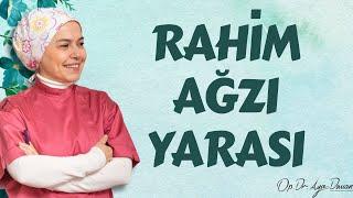 Rahim Ağzı Yarası