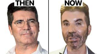 Simon Cowell NEW FACE  Plastic Surgery Analysis