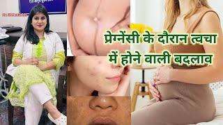 प्रेग्नेंसी के दौरान त्वचा में होने वाली बदलाव Skin changes during pregnancy #pregnancy #newvideo