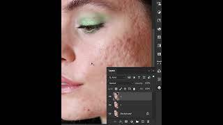 Remove Skin Blemishes in Photoshop - Tutorial    #shorts #photoshop