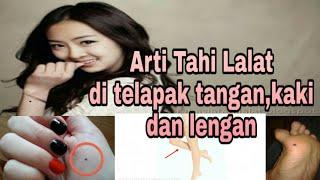 Arti Tahi Lalat Di Telapak TanganKaki Dan Lengan