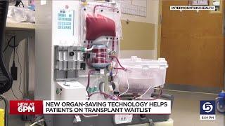 New organ-saving technology helps patients on transplant waitlist