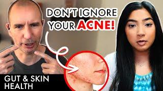 ️ Long Term Risks of Ignoring Acne  Gut & Skin Connection From Acne to Wellness 